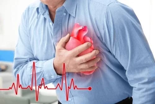 Cardiolgos alertan sobre riesgo de infartos entre los 45 y 55 años